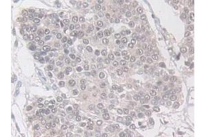 Immunohistochemistry (IHC) image for anti-VAMP (Vesicle-Associated Membrane Protein)-Associated Protein B and C (VAPB) (AA 1-132) antibody (ABIN7443908)