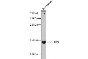Western blot analysis of extracts of Rat spleen using S100A9 Polyclonal Antibody at dilution of 1:1000. (S100A9 Antikörper)