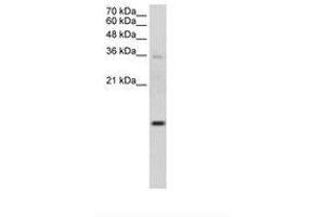 Image no. 1 for anti-Ubiquitin-Conjugating Enzyme E2D 2 (UBE2D2) (AA 91-140) antibody (ABIN203474)