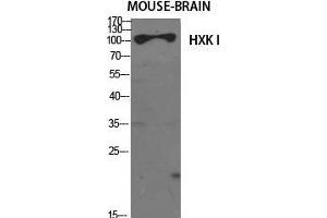Western Blot (WB) analysis of specific cells using HXK I Polyclonal Antibody. (HXK I (N-Term) Antikörper)
