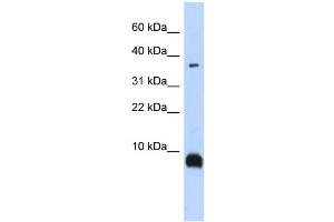 WB Suggested Anti-TAC3 Antibody Titration:  0. (Tachykinin 3 Antikörper  (Middle Region))