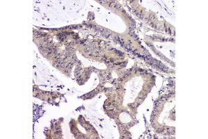IHC analysis of PPCS using anti-PPCS antibody (ABIN6719631).