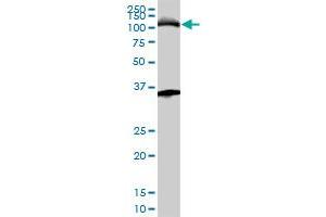 MCM3 monoclonal antibody (M01A), clone 4F7. (MCM3 Antikörper  (AA 699-808))