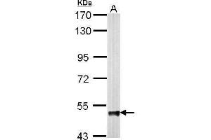 Western Blotting (WB) image for anti-4-Aminobutyrate Aminotransferase (ABAT) antibody (ABIN2854765)
