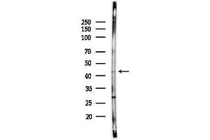 anti-DnaJ (Hsp40) Homolog, Subfamily B, Member 14 (DNAJB14) (C-Term) antibody