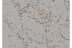 ABIN6274946 at 1/100 staining Human lung tissue by IHC-P. (CAGE1 Antikörper  (C-Term))