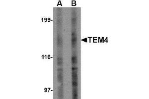 Western blot analysis of TEM4 in Jurkat Cell lysate with TEM4 antibody at (A) 1 and (B) 2 µg/ml. (ARHGEF17 Antikörper)