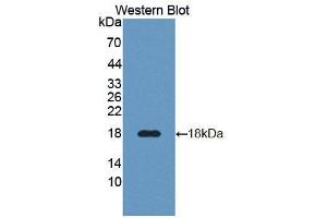 Western blot analysis of the recombinant protein. (DR3/LARD Antikörper  (AA 38-167))