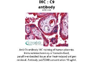 Image no. 2 for anti-Complement Component C9 (C9) (AA 184-411) antibody (ABIN1732510) (C9 Antikörper  (AA 184-411))