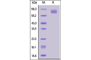 SARS-CoV-2 S2 protein (T1027I, V1176F), His Tag on  under reducing (R) condition. (SARS-CoV-2 Spike S2 Protein (P.1 - gamma) (His tag))