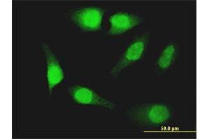 Immunofluorescence of monoclonal antibody to FOXO1 on HeLa cell. (FOXO1 Antikörper  (AA 452-555))