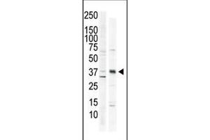 The anti-CK1 C-term Pab (ABIN391310 and ABIN2841344) is used in Western blot to detect CK1 in HeLa cell lysate (lane 1) and primate brain tissue lysate (lane 2). (CAMK1 Antikörper  (C-Term))