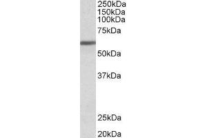 Western Blotting (WB) image for Zinc Finger Protein 703 (ZNF703) peptide (ABIN369017) (Zinc Finger Protein 703 (ZNF703) Peptid)