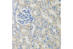 Immunohistochemistry of paraffin-embedded rat kidney using CCL26 antibody at dilution of 1:200 (40x lens).