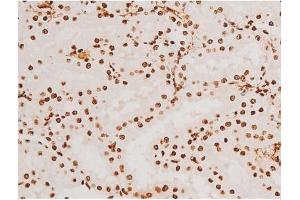ABIN6267523 at 1/200 staining Rat kidney tissue sections by IHC-P. (SYK Antikörper  (pTyr348))