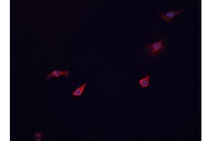 ABIN6268866 staining HeLa cells by IF/ICC. (Glucagon Receptor Antikörper  (Internal Region))