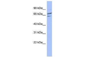 PGM1 antibody used at 1 ug/ml to detect target protein. (Phosphoglucomutase 1 Antikörper  (Middle Region))