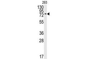 Image no. 1 for anti-Bone Morphogenetic Protein Receptor 1A (BMPR1A) (N-Term) antibody (ABIN357374) (BMPR1A Antikörper  (N-Term))