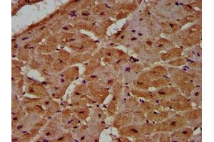 Immunohistochemistry (IHC) image for anti-Mutated in Colorectal Cancers (MCC) (AA 479-611) antibody (ABIN7148294)