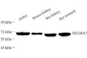 Western blot analysis of SLC26A7 (ABIN7075670) at dilution of 1: 1000 (SLC26A7 Antikörper)