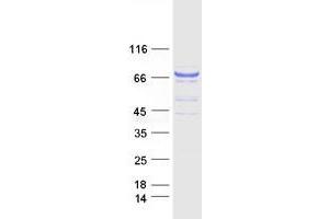 Western Blotting (WB) image for Guanylate Cyclase 1 Soluble Subunit Alpha (GUCY1A1) (Transcript Variant 1) protein (Myc-DYKDDDDK Tag) (ABIN2722369)