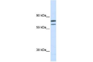 WB Suggested Anti-ZFPM1 Antibody Titration:  0. (ZFPM1 Antikörper  (N-Term))