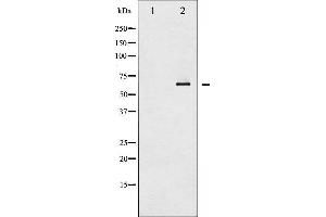 Western blot analysis of SYK expression in UV treated K562 whole cell lysates,The lane on the left is treated with the antigen-specific peptide.