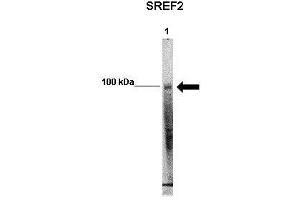 WB Suggested Anti-SREBF2 Antibody    Positive Control:  Lane 1: 50ug mouse glomerular endothelial lysate   Primary Antibody Dilution :   1:1000   Secondary Antibody :  Anti-rabbit-HRP   Secondry Antibody Dilution :   1:5000   Submitted by:  Xiaoxin Wang, UC Denver (SREBF2 Antikörper  (Middle Region))