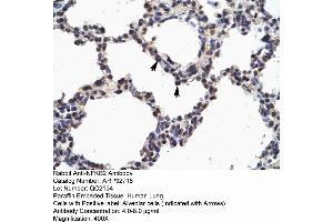 Human Lung (NFKB2 Antikörper  (N-Term))