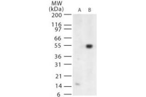 Image no. 1 for anti-West Nile Virus (WNV) (AA 73-86) antibody (ABIN199990) (West Nile Virus Antikörper  (AA 73-86))