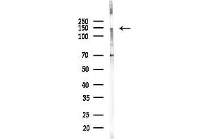 anti-Tripartite Motif Containing 66 (TRIM66) antibody