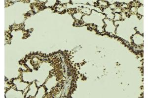 ABIN6268967 at 1/100 staining Mouse lung tissue by IHC-P. (DAXX Antikörper  (C-Term))