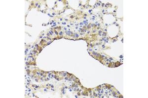 Immunohistochemistry of paraffin-embedded mouse lung using TOMM34 antibody (ABIN5972523) at dilution of 1/100 (40x lens). (TOMM34 Antikörper)