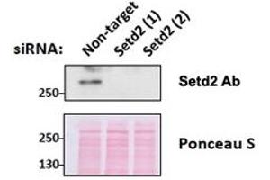 Western blot testing of mouse fibroblast lysates transiently expressing unrelated and two different siRNA with SETD2 antibody at 0. (SETD2 Antikörper)