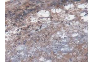 Immunohistochemistry (IHC) image for anti-Glutaredoxin 3 (GLRX3) (AA 73-320) antibody (ABIN7443266)