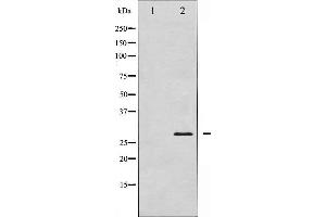 Western blot analysis of TNNI3 expression in Mouse hearttissue lysates,The lane on the left is treated with the antigen-specific peptide. (TNNI3 Antikörper)