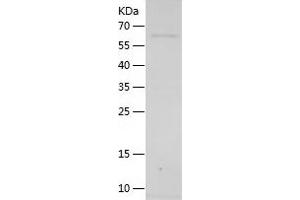 Western Blotting (WB) image for Dopamine beta-Hydroxylase (Dopamine beta-Monooxygenase) (DBH) (AA 40-617) protein (His tag) (ABIN7122701) (DBH Protein (AA 40-617) (His tag))