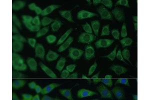 Immunofluorescence analysis of L929 cells using ARL3 Polyclonal Antibody at dilution of 1:100 (40x lens).