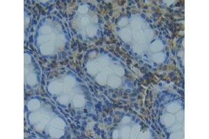 Used in DAB staining on fromalin fixed paraffin- embedded rectum tissue (TCEB1 Antikörper  (AA 1-112))