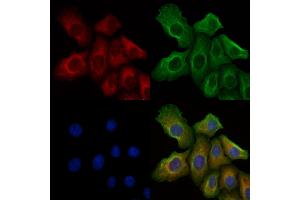 ABIN6256027 and ABIN6267368 staining H2O2 treated Hela cells by IF/ICC. (FGFR1 Antikörper  (pTyr766))