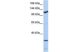 Western Blotting (WB) image for anti-Oncostatin M Receptor (OSMR) antibody (ABIN2459017) (Oncostatin M Receptor Antikörper)