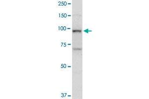 TOP1 monoclonal antibody (M01), clone 1A1.