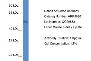Western Blotting (WB) image for anti-Arylsulfatase B (ARSB) (Middle Region) antibody (ABIN786015) (Arylsulfatase B Antikörper  (Middle Region))