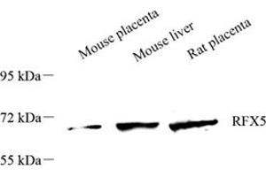 Western blot analysis of RFX5 (ABIN7075399),at dilution of 1: 1500 (RFX5 Antikörper)