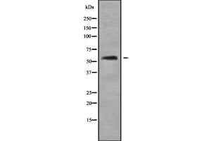 Western blot analysis of AGXT2 using COLO205 whole cell lysates (AGXT2 Antikörper  (Internal Region))