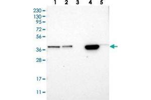 Western blot analysis of Lane 1: RT-4, Lane 2: U-251 MG, Lane 3: Human Plasma, Lane 4: Liver, Lane 5: Tonsil with SLC35E1 polyclonal antibody  at 1:250-1:500 dilution. (SLC35E1 Antikörper)