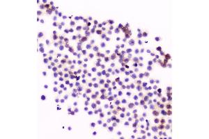 IHC analysis of CD11a using anti-CD11a antibody (ABIN5518766).