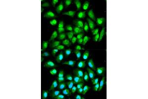 Immunofluorescence analysis of HeLa cells using RAN antibody (ABIN5970364). (RAN Antikörper)