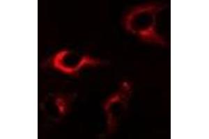 Immunofluorescent analysis of FKBP8 staining in A549 cells. (FKBP8 Antikörper)