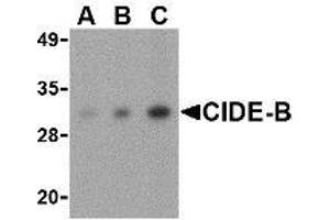 Western blot analysis of CIDE-B in mouse small intestine tissue lysate with AP30233PU-N CIDE-B antibody at (A) 0. (CIDEB Antikörper  (Center))